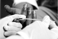 Obama undergoes a rapid HIV blood test.